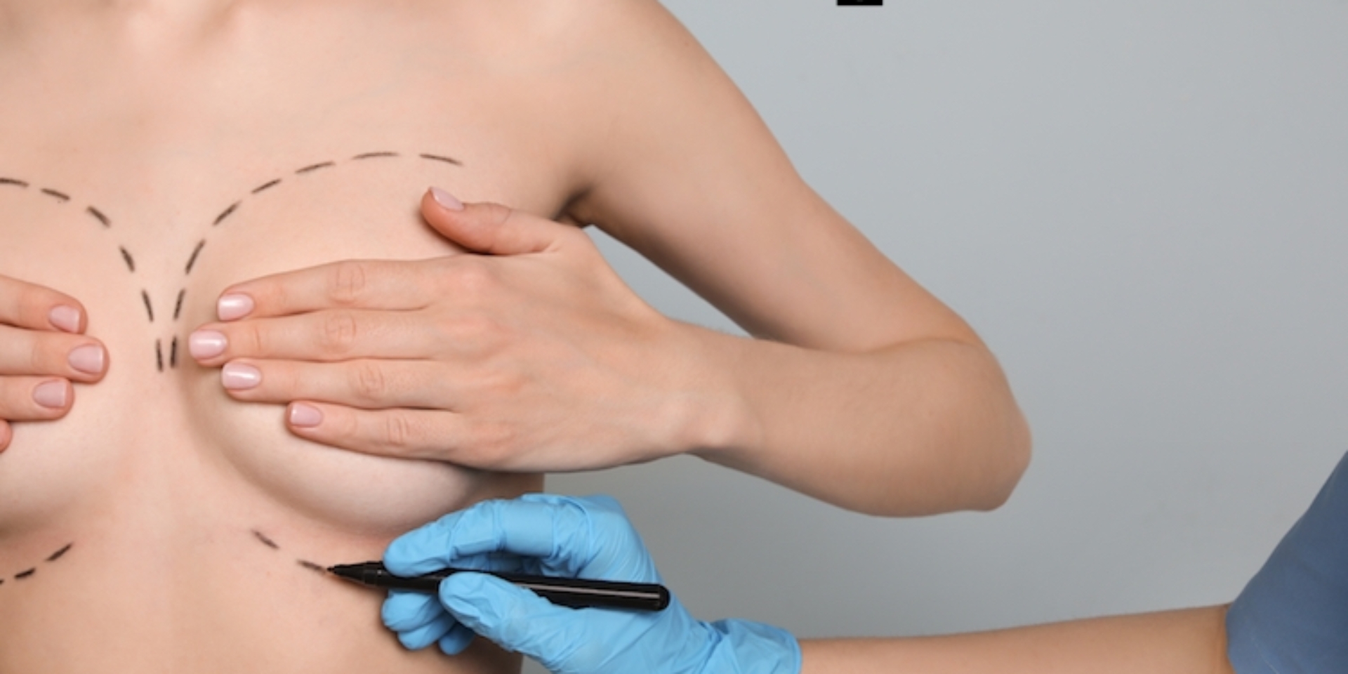 Doctor drawing marks on female breast for cosmetic surgery operation against color background